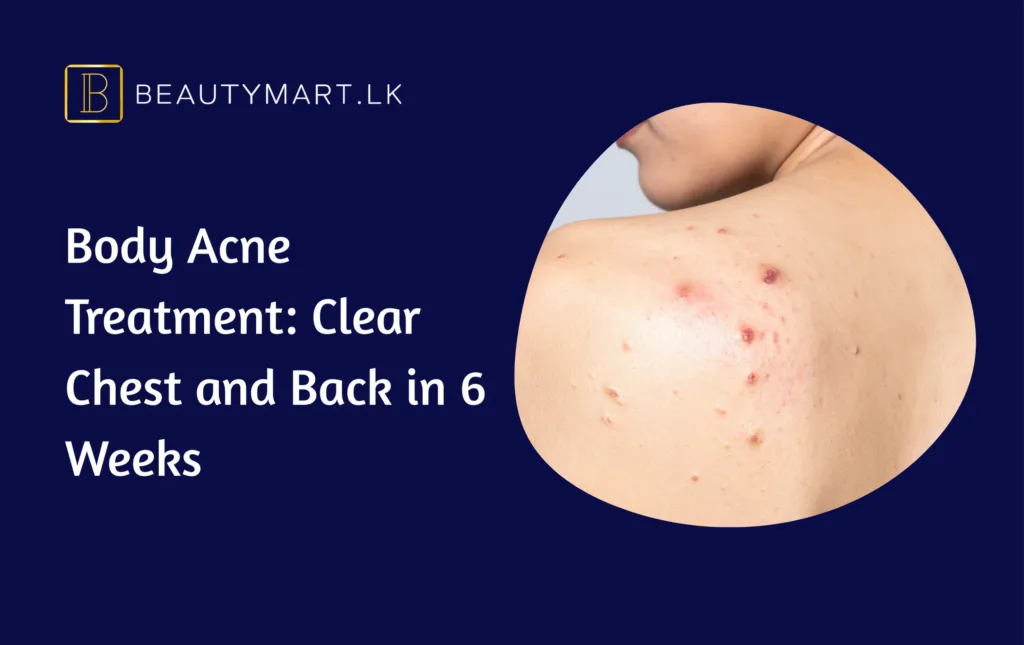 Body Acne Treatment Clear Chest and Back in 6 Weeks
